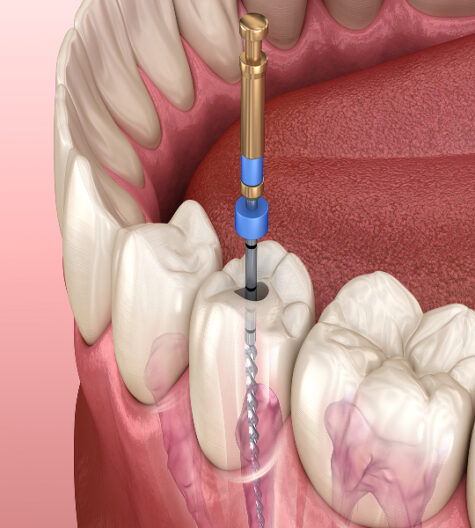 Endodontija